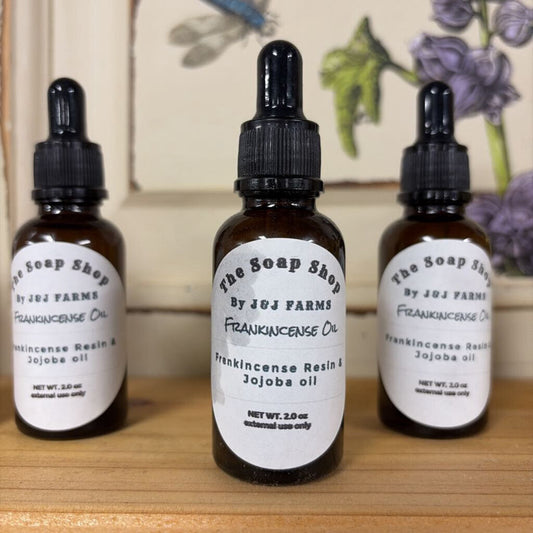 4. Frankincense Oil